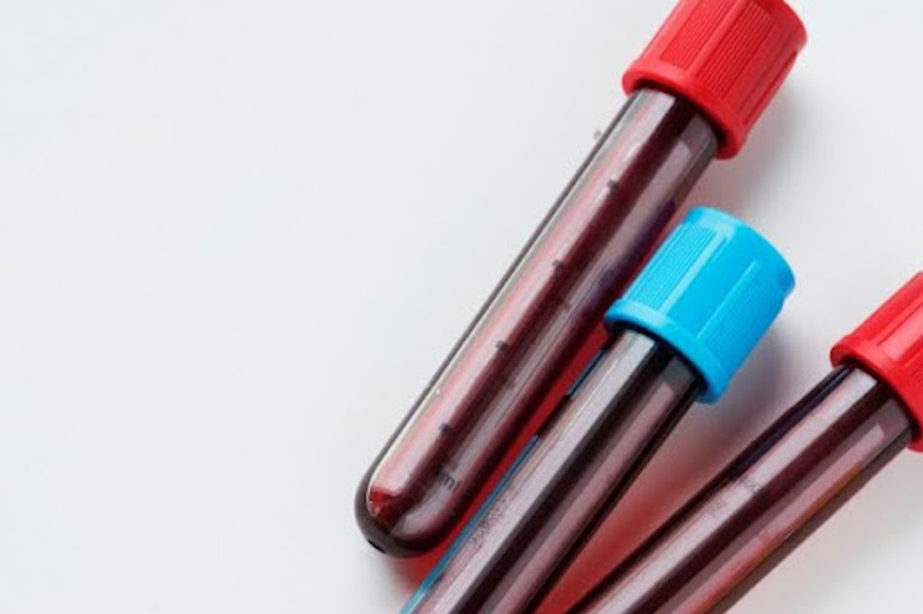 VGM lev et fatigue : focus sur vos globules rouges VGM lev et fatigue : focus sur vos globules rouges